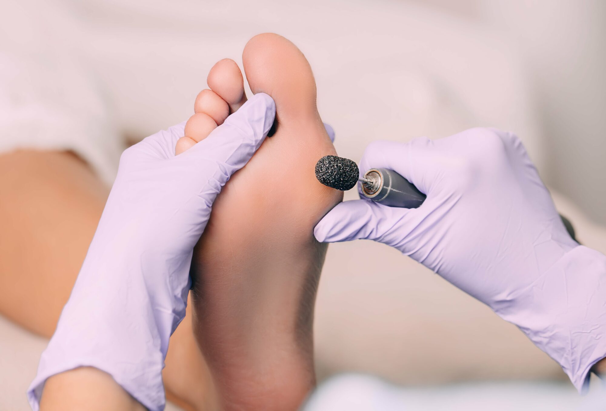 Fußpfleger, der die Füße poliert und die Haut mit einem speziellen Werkzeug entfernt.
